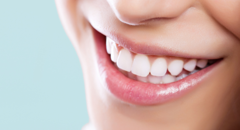 diseno de sonrisa en estados unidos