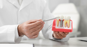 Seguro dental para implantes dentales