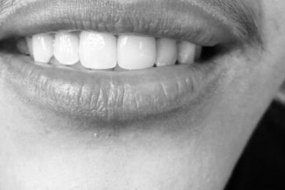 Clovis Cosmetic Dentistry