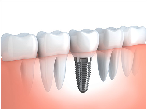 Dentistas En Guayanilla