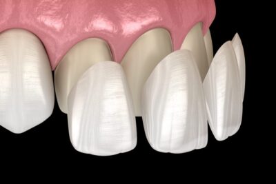 Dentistas En Menifee