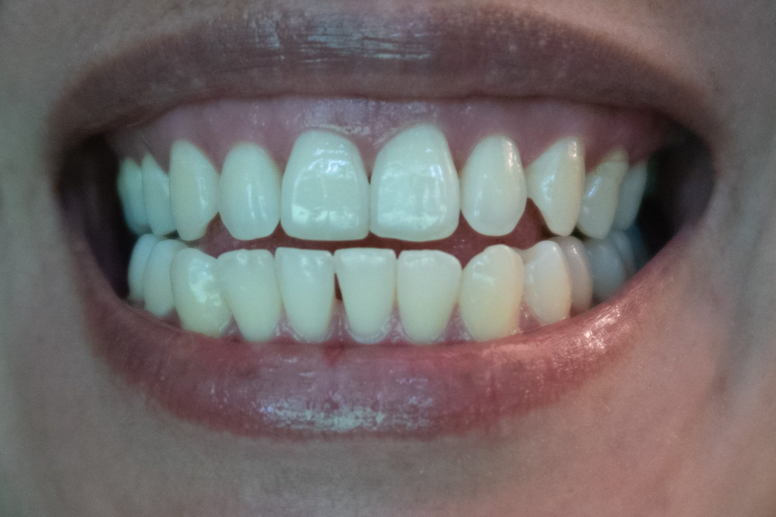 Dentistas En San Sebastián