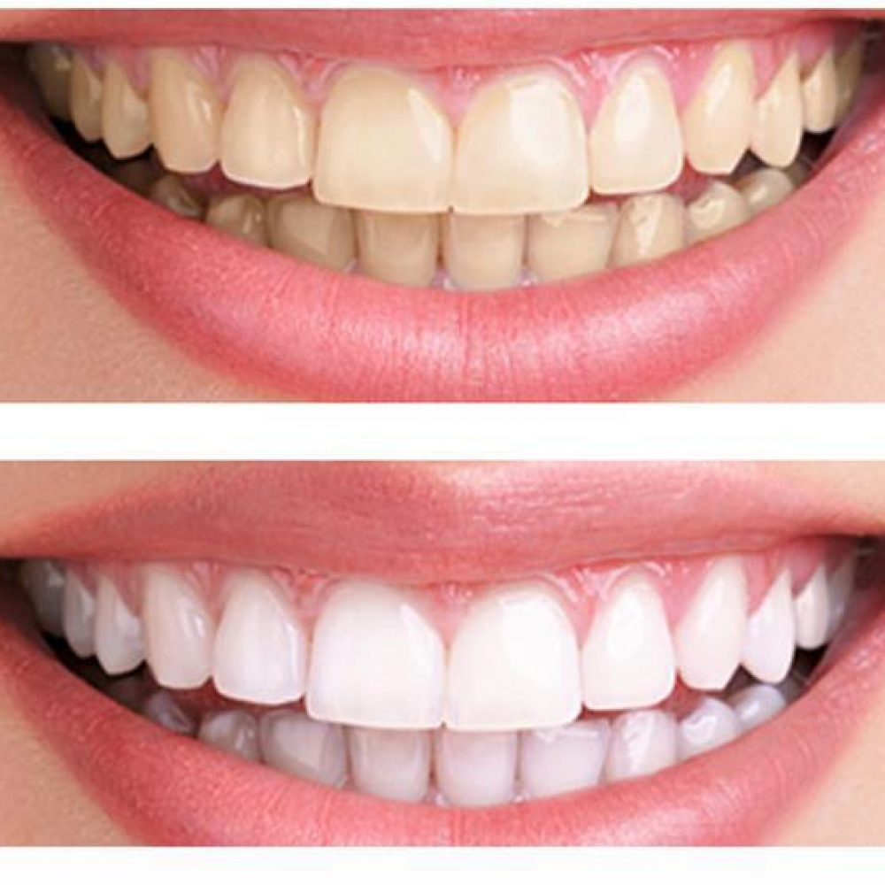 Dentistas En Spring