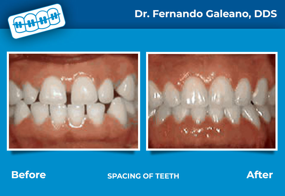 Dentistas En Tampa
